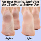 Natural Pumice Stone for Feet: Scrubber, Dead Skin Scraper Exfoliator, Pedicure Tools