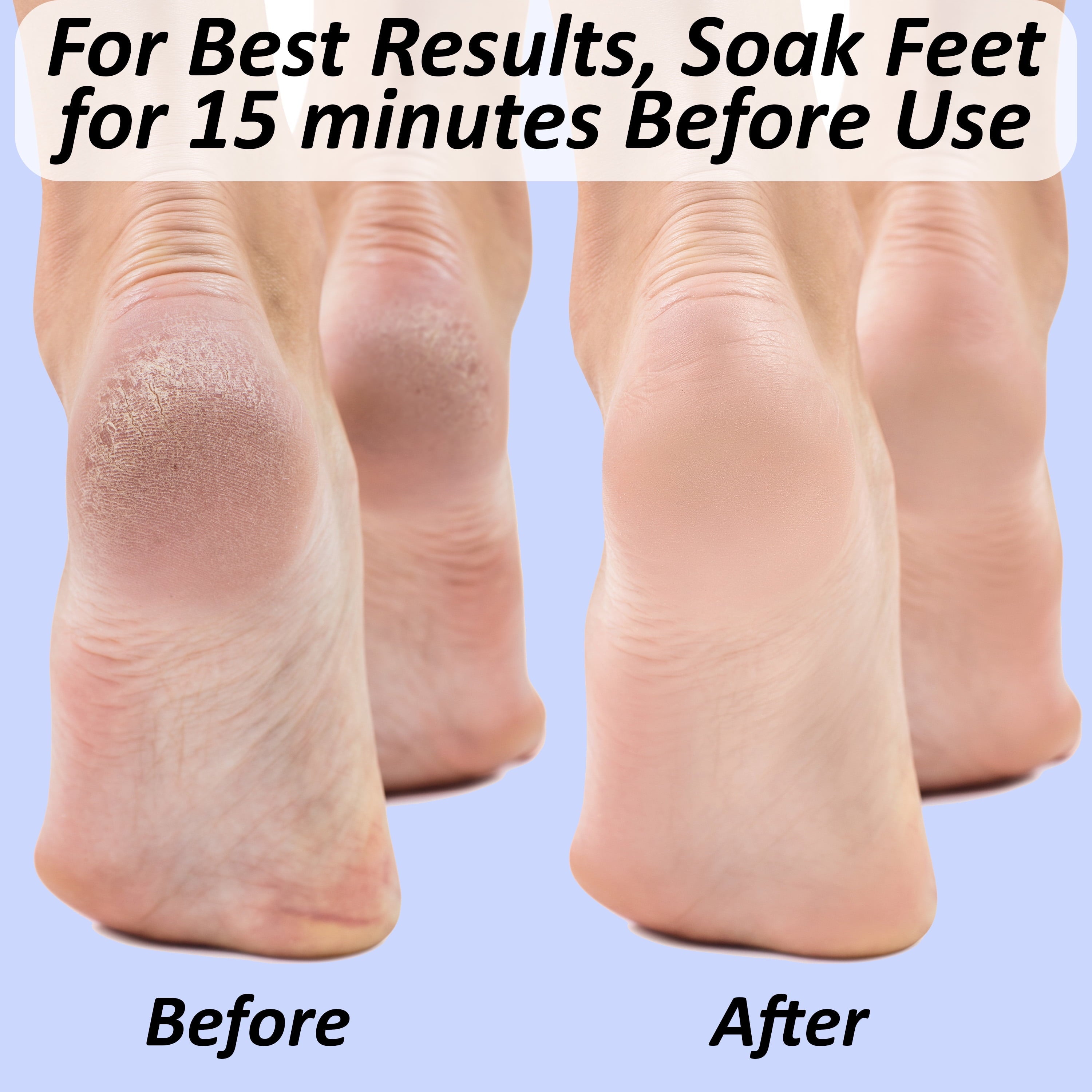 Natural Pumice Stone for Feet: Scrubber, Dead Skin Scraper Exfoliator, Pedicure Tools